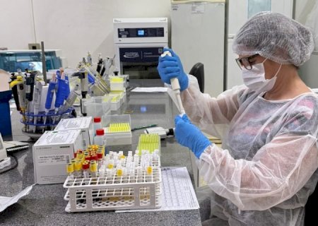 MS lidera o paÃs em testagens e se torna referência em vigilância laboratorial e epidemiológica
